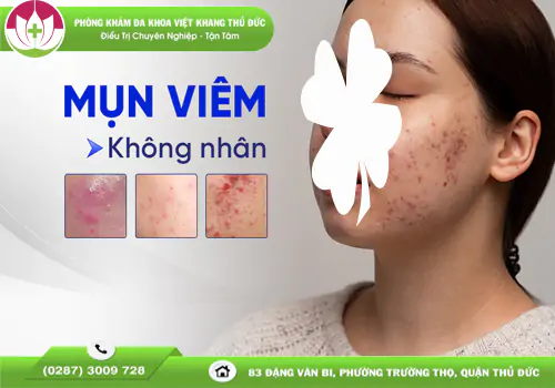 mun-viem-khong-nhan-la-gi-nguyen-nhan-va-cach-tri-2050