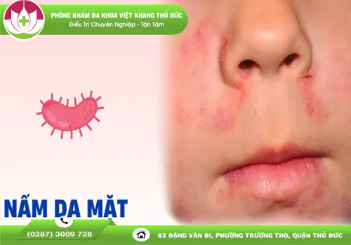 nam-da-mat-la-gi-nhan-biet-va-dieu-tri-dung-cach-2074