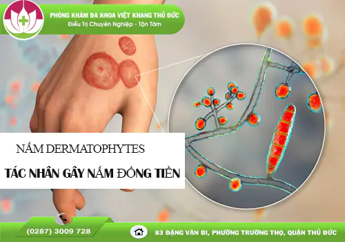 nam-dong-tien-khi-nao-can-gap-bac-si-da-lieu-2073