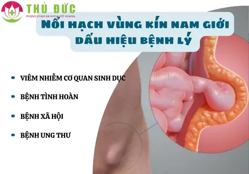 nam-gioi-lo-lang-ve-hien-tuong-noi-hach-vung-kin-1253