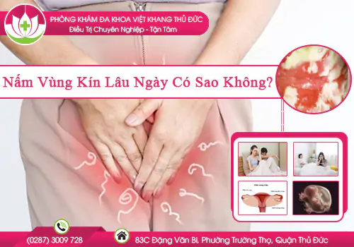 nam-vung-kin-lau-ngay-co-sao-khong-884