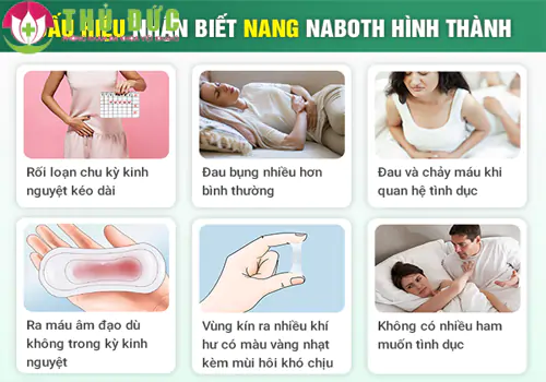 Các dấu hiệu nhận biết nang naboth chị em cần lưu ý