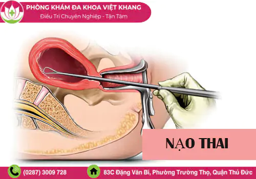 nao-thai-la-gi-quy-trinh-chi-phi-va-nhung-dieu-can-biet-2115