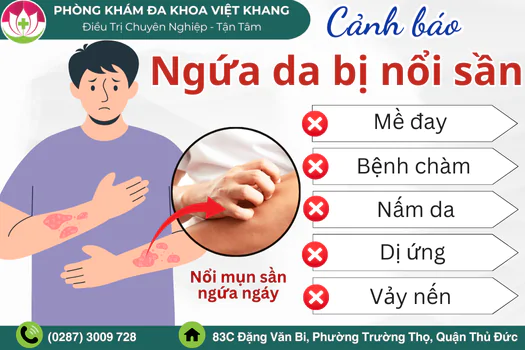 ngua-da-bi-noi-san-la-do-dau-cach-dieu-tri-the-nao-1814
