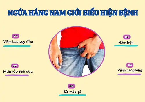 ngua-hang-nam-gioi-nguyen-nhan-dau-hieu-va-cach-dieu-tri-1090