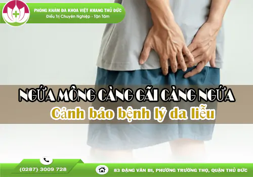 ngua-mong-cang-gai-cang-ngua-dung-de-keo-dai-gay-bien-chung-2080