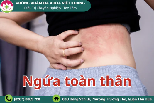 bi-ngua-toan-than-cang-gai-cang-ngua-co-phai-benh-da-lieu-1816