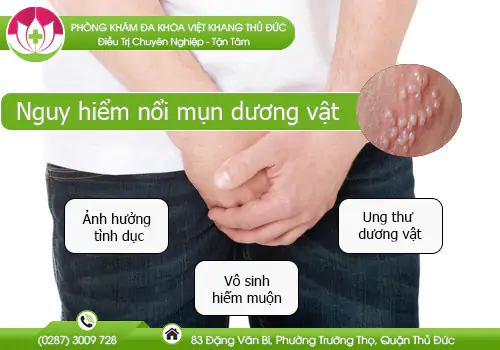 nam-gioi-khong-nen-chu-quan-khi-noi-mun-duong-vat-692