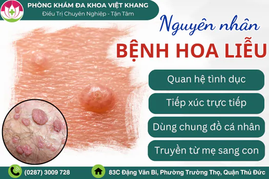 benh-hoa-lieu-la-gi-nguyen-nhan-bieu-hien-va-cach-dieu-tri-1223