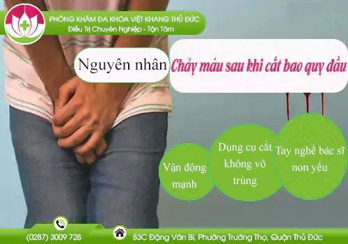 chay-mau-sau-khi-cat-bao-quy-dau-do-dau-623