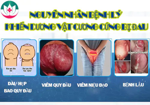 nguyen-nhan-duong-vat-cuong-cung-bi-dau-tham-kham-o-dau-1184