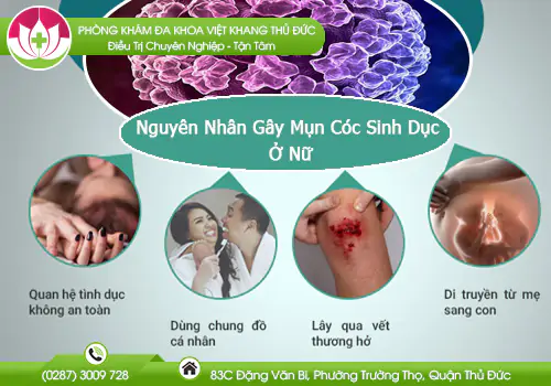 tim-hieu-nguyen-nhan-gay-mun-coc-sinh-duc-o-nu-899
