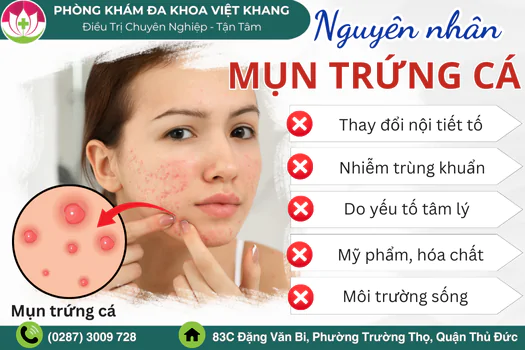 nguyen-nhan-moc-mun-trung-ca-dau-hieu-nhan-biet-1878