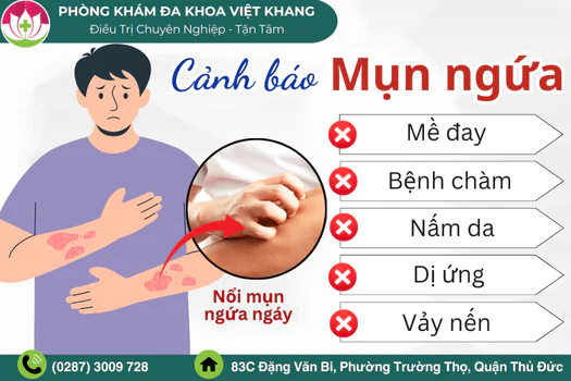 nguyen-nhan-noi-mun-ngua-cach-dieu-tri-hieu-qua-1807