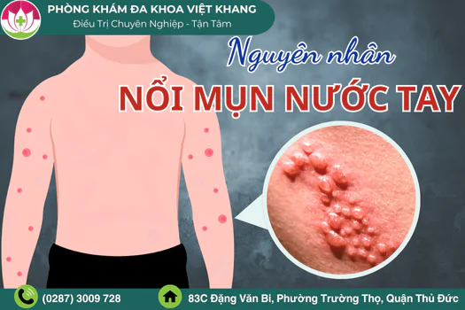 noi-mun-nuoc-tay-gay-ngua-canh-bao-benh-da-lieu-1765