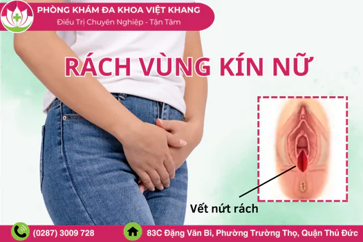 nguyen-nhan-rach-vung-kin-nu-gioi-cach-khac-phuc-nhanh-1465