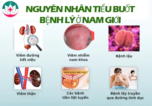 Nguyên nhân tiểu buốt bệnh lý ở nam giới