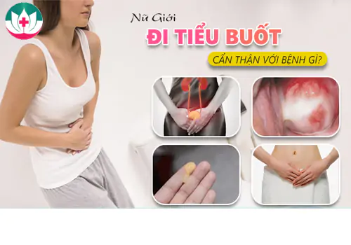 Nguyên nhân tiểu buốt bệnh lý ở nữ giới