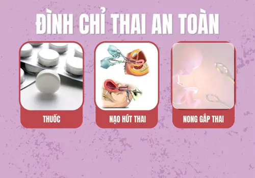 Phương pháp phá thai an toàn được chỉ định áp dụng phù hợp từng tuần tuổi thai