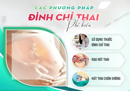 Phương pháp đình chỉ thai an toàn