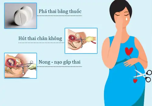 Những phương pháp đình chỉ thai kỳ an toàn