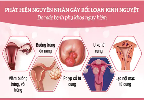 Trễ kinh 3 ngày có thể do bệnh lý 