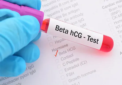  Xét nghiệm HCG là giúp thai phụ phát hiện mình có thai từ giai đoạn sớm