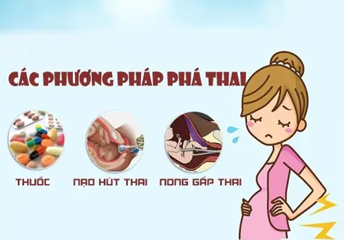 Phương pháp đình chỉ thai kỳ an toàn