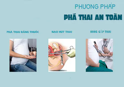 Phương pháp phá thai an toàn, phổ biến