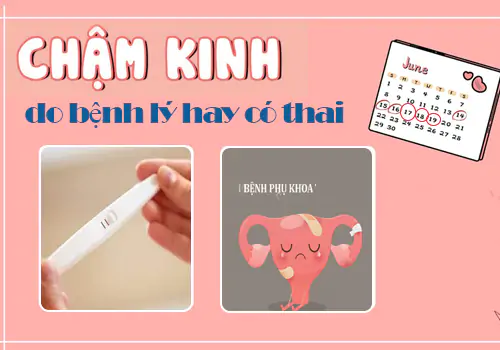 nguyen-nhan-tre-kinh-6-ngay-dau-hieu-cua-benh-ly-hay-co-thai-1108