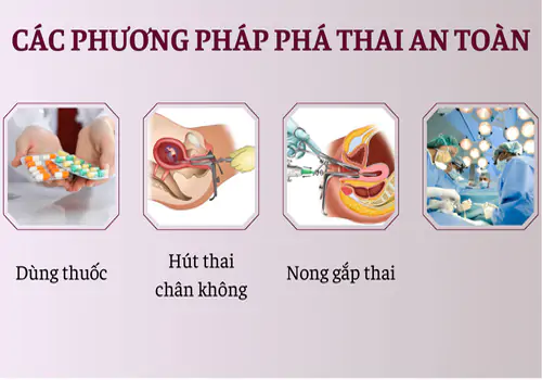 Các phương pháp phá thai an toàn được áp dụng