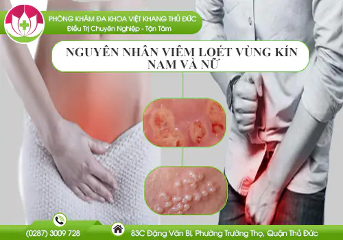 viem-loet-vung-kin-o-nam-va-nu-nguyen-nhan-do-dau-811