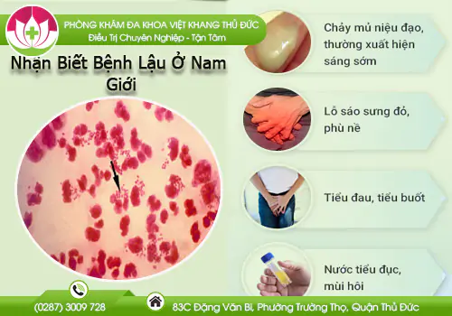 nhan-biet-benh-lau-o-nam-gioi-va-cach-chua-tri-hien-nay-947
