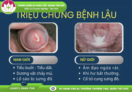 nhan-biet-dau-hieu-benh-lau-som-de-tranh-hau-qua-nguy-hiem-2006