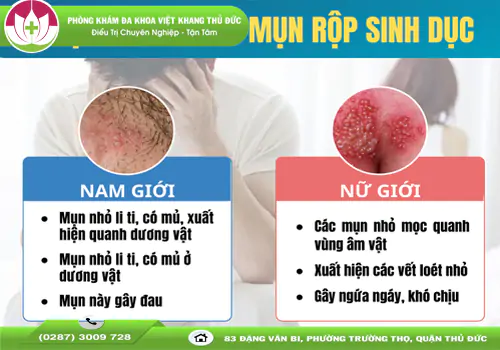 nhan-biet-dau-hieu-mun-rop-sinh-duc-o-nam-va-nu-gioi-1617
