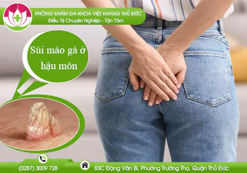 nhan-biet-sui-mao-ga-o-hau-mon-832