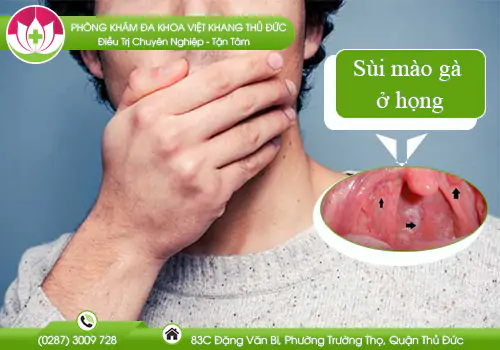 nhan-biet-sui-mao-ga-o-hong-831