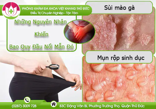 nhung-nguyen-nhan-khien-bao-quy-dau-noi-man-do-935