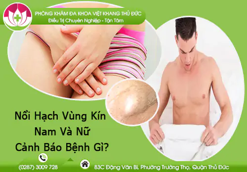 noi-hach-vung-kin-nam-va-nu-canh-bao-benh-gi-914