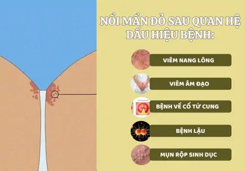 noi-man-do-sau-quan-he-hien-tuong-khong-nen-xem-thuong-1158