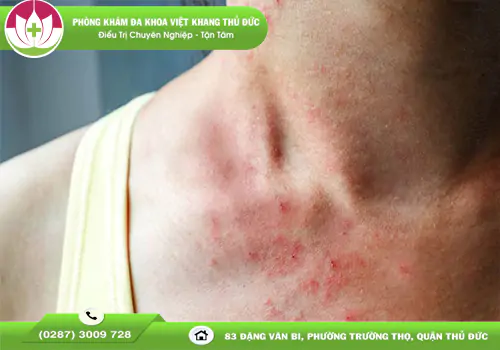 Việt Khang Thủ Đức