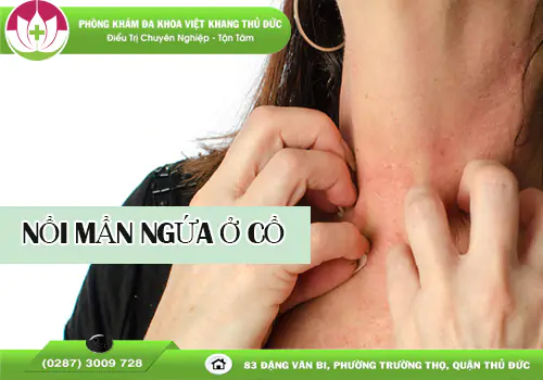 noi-man-ngua-o-co-can-than-voi-nhung-benh-da-lieu-2076