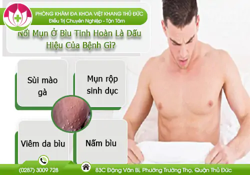 noi-mun-o-biu-tinh-hoan-la-dau-hieu-cua-benh-gi-917