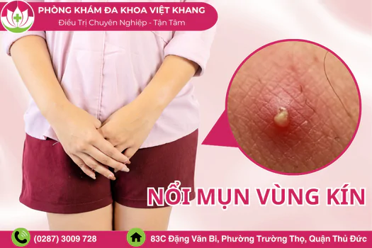 noi-mun-vung-kin-co-nguy-hiem-khong-nguyen-nhan-va-cach-dieu-tri-1363