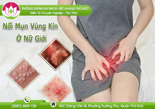 noi-mun-vung-kin-o-nu-gioi-va-cach-dieu-tri-hieu-qua-986