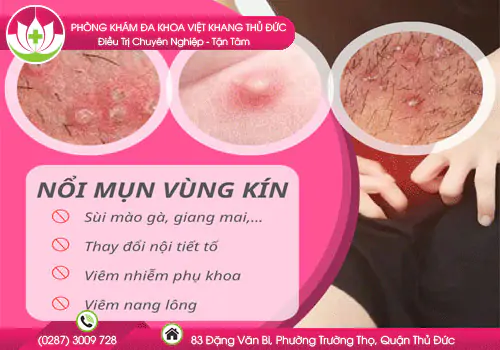 noi-mun-vung-kin-la-benh-gi-chua-bang-phuong-phap-nao-203