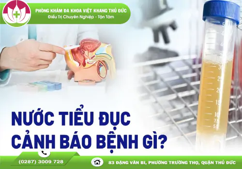 nuoc-tieu-bi-duc-la-benh-gi-va-cach-dieu-tri-hieu-qua-1943
