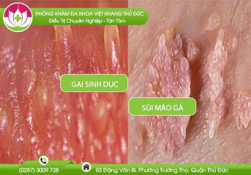 phan-biet-gai-sinh-duc-voi-sui-mao-ga-ra-sao-637