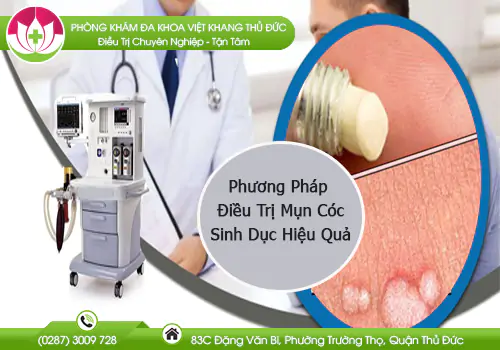 phuong-phap-dieu-tri-mun-coc-sinh-duc-hieu-qua-900