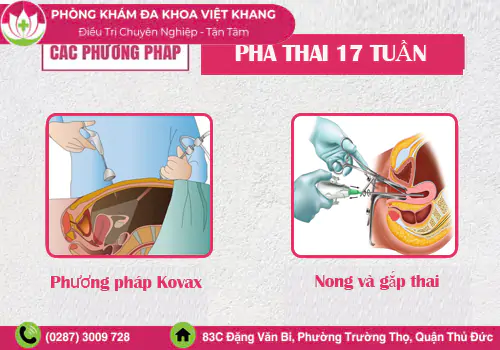 phuong-phap-pha-thai-17-tuan-hien-nay-2141